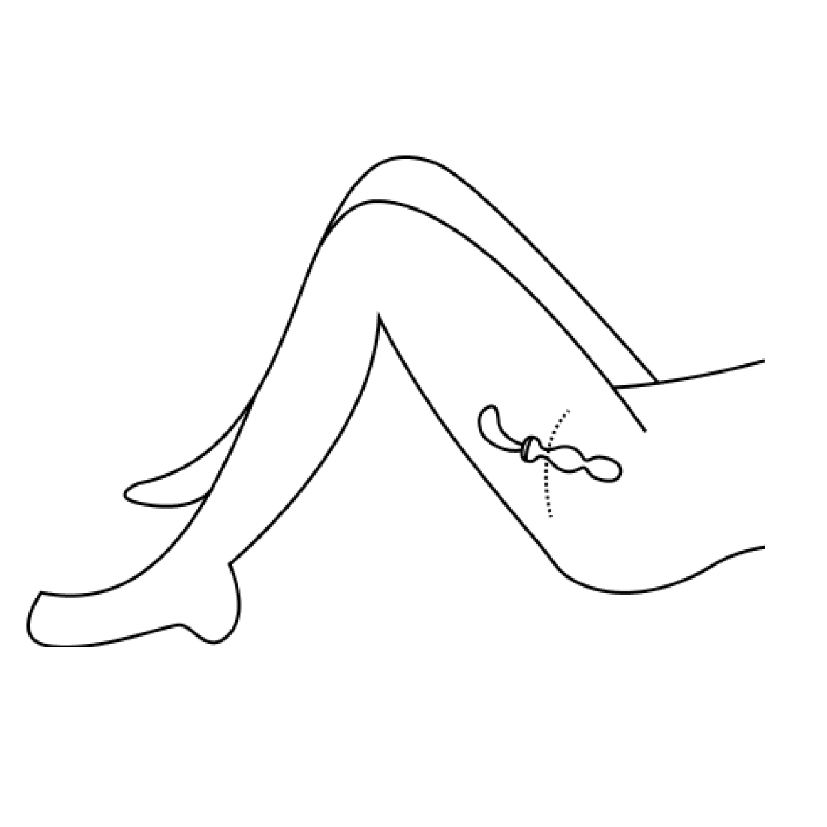 Perifit Diagram